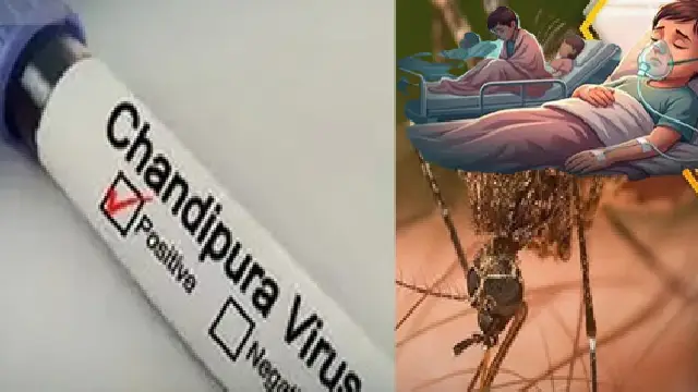Chandipura Virus Chandipura Virus