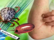Scrub typhus in Odisha: Medical teams to be sent for surveillance in affected areas, says Health Minister scrub typhus in odisha